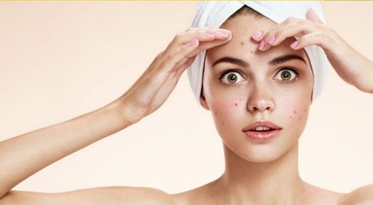  Top Moisturisers for Acne-Prone Skin 